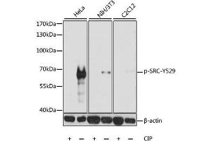 Western blot analysis of extracts of various cell lines, using Phospho-SRC-Y529 antibody. (Src 抗体  (pTyr529))