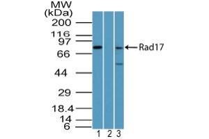 Image no. 1 for anti-RAD17 (RAD17) antibody (ABIN960319) (RAD17 抗体)