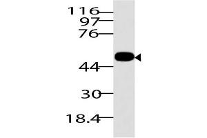 Image no. 1 for anti-RuvB-Like 1 (E. Coli) (RUVBL1) (AA 1-268) antibody (ABIN5027513) (RUVBL1 抗体  (AA 1-268))