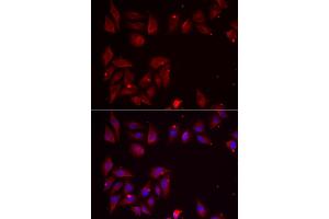 Immunofluorescence analysis of U2OS cells using PDXK antibody (ABIN5974032). (PDXK 抗体)