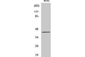 Western Blotting (WB) image for anti-Ret Finger Protein-Like 4A (RFPL4A) (Internal Region) antibody (ABIN3186740) (RFPL4A 抗体  (Internal Region))