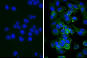 Human pancreatic carcinoma cell line MIA PaCa-2 was stained with Mouse Anti-Human CD44-UNLB, and DAPI. (兔 anti-小鼠 IgG (Heavy & Light Chain) Antibody (Biotin))