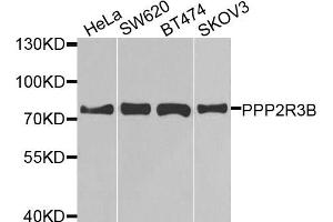 Western blot analysis of extracts of various cell lines, using PPP2R3B antibody (ABIN5974610) at 1/1000 dilution. (PPP2R3B 抗体)