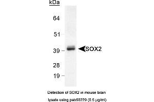 Image no. 2 for anti-SRY (Sex Determining Region Y)-Box 2 (SOX2) (AA 1-100), (N-Term) antibody (ABIN363538) (SOX2 抗体  (N-Term))