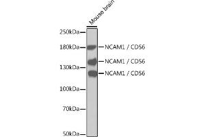 Western blot analysis of extracts of mouse brain, using NC / CD56 antibody (ABIN1679098, ABIN3015129 and ABIN7101312). (CD56 抗体)