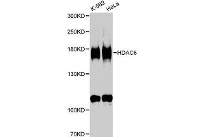 Western blot analysis of extracts of various cell lines, using HDAC6 antibody (ABIN5970867) at 1/1000 dilution. (HDAC6 抗体)