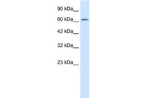 WB Suggested Anti-FLJ12644 Antibody Titration:  1. (FLJ12644 (C-Term) 抗体)