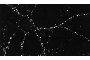 ICC of PSD95 in cultures of dissociated hippocampal neurons. (DLG4 抗体  (PE))