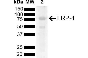 Western blot analysis of Rat Kidney showing detection of 504. (LRP1 抗体  (AA 2880-2980) (FITC))