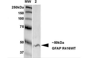 Western Blot analysis of Rat Brain Membrane showing detection of GFAP protein using Mouse Anti-GFAP Monoclonal Antibody, Clone S206B-9 . (GFAP 抗体  (AA 411-422) (Biotin))