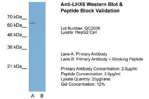 Host:  Rabbit  Target Name:  LHX6  Sample Type:  HepG2  Lane A:  Primary Antibody  Lane B:  Primary Antibody + Blocking Peptide  Primary Antibody Concentration:  2. (LHX6 抗体  (C-Term))