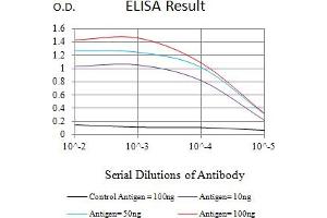 Black line: Control Antigen (100 ng),Purple line: Antigen (10 ng), Blue line: Antigen (50 ng), Red line:Antigen (100 ng) (MSH6 抗体  (AA 374-540))