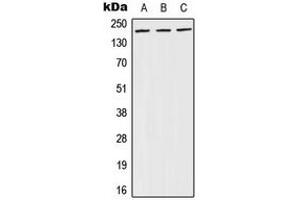 Western blot analysis of BRCA1 (pS1524) expression in A431 (A), NIH3T3 (B), PC12 (C) whole cell lysates. (BRCA1 抗体  (C-Term, pSer1524))