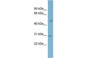 WB Suggested Anti-NDUFS3 Antibody Titration: 0. (NDUFS3 抗体  (Middle Region))