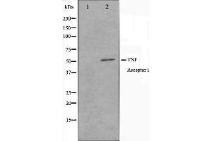 Western blot analysis of TNFR1 Antibody expression in A549 cells lysates. (TNFRSF1A 抗体  (C-Term))