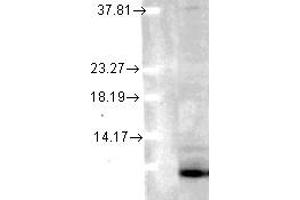 Image no. 1 for anti-Ubiquitin (Ubiquitin) antibody (ABIN1502295) (Ubiquitin 抗体)