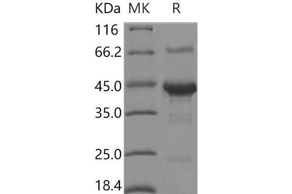 SHISA3 Protein (Fc Tag)