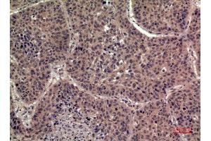 Immunohistochemistry (IHC) analysis of paraffin-embedded Human Lung, antibody was diluted at 1:100. (FIL1h 抗体  (Internal Region))