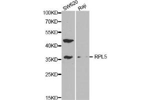 Western Blotting (WB) image for anti-Ribosomal Protein L5 (RPL5) antibody (ABIN1874650) (RPL5 抗体)