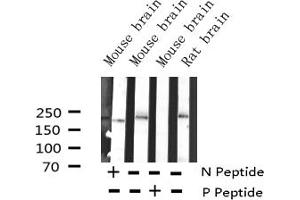 Western blot analysis of Phospho-BRCA1 (Ser1524) Antibody expression in mouse brain and rat brain tissues lysates. (BRCA1 抗体  (pSer1524))