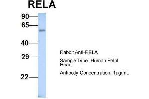 Host: Rabbit  Target Name: RELA  Sample Tissue: Human Fetal Heart  Antibody Dilution: 1. (NF-kB p65 抗体  (Middle Region))