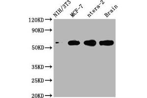 Western Blot Positive WB detected in: NIH/3T3 whole cell lysate, MCF-7 whole cell lysate, ntera-2 whole cell lysate, Mouse brain tissue All lanes: PAK1 antibody at 1:2000 Secondary Goat polyclonal to rabbit IgG at 1/50000 dilution Predicted band size: 61, 62 kDa Observed band size: 61 kDa (Recombinant PAK1 抗体)