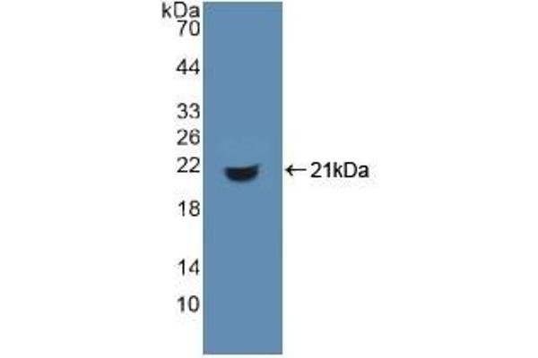 CD74 抗体  (AA 64-205)
