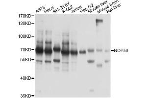Western blot analysis of extracts of various cell lines, using NOP58 antibody. (NOP58 抗体)