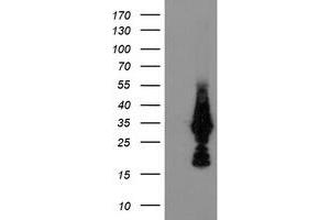 HEK293T cells were transfected with the pCMV6-ENTRY control (Left lane) or pCMV6-ENTRY MMACHC (Right lane) cDNA for 48 hrs and lysed. (MMACHC 抗体)