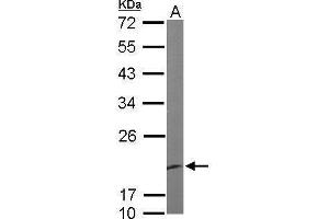 WB Image Sample (50 ug of whole cell lysate) A: Mouse brain 12% SDS PAGE antibody diluted at 1:1000 (EEF1E1 抗体)