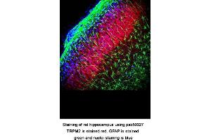 Image no. 1 for anti-Transient Receptor Potential Cation Channel, Subfamily M, Member 2 (TRPM2) (AA 1430-1508), (C-Term) antibody (ABIN363636) (TRPM2 抗体  (C-Term))