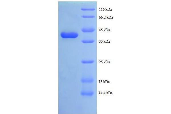 TAX1BP3 Protein (AA 1-124, full length) (GST tag)