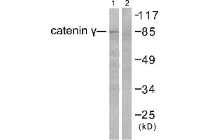 Western blot analysis of extracts from HeLa cells, using Catenin-γ antibody. (JUP 抗体)