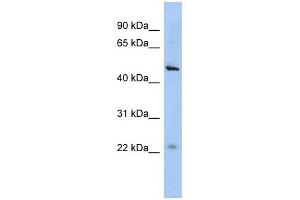 C12ORF50 antibody used at 1 ug/ml to detect target protein. (C12ORF50 抗体  (N-Term))