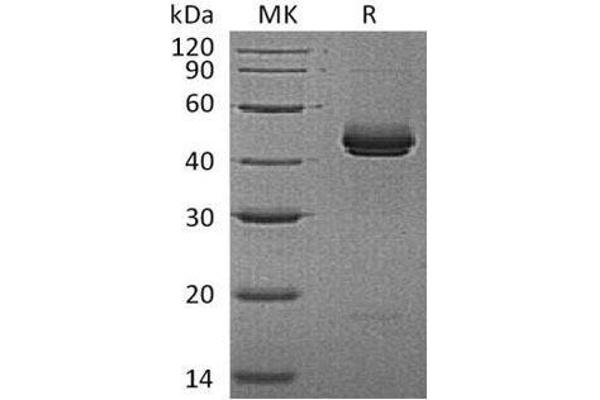 IL12B Protein (His tag)