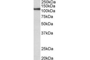 AP31686PU-N (0. (Thyroperoxidase 抗体  (Internal Region))