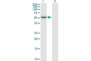 Western Blot analysis of CALCOCO2 expression in transfected 293T cell line by CALCOCO2 monoclonal antibody (M07), clone 1A11. (CALCOCO2 抗体  (AA 347-446))