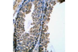 Immunohistochemical analysis of SRY staining in human testis formalin fixed paraffin embedded tissue section. (SRY 抗体  (Center))