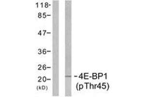 Western blot analysis of extracts from MDA-MB-435 cells treated with EGF 200ng/ml 5', using 4E-BP1 (Phospho-Thr45) Antibody. (eIF4EBP1 抗体  (pThr46))