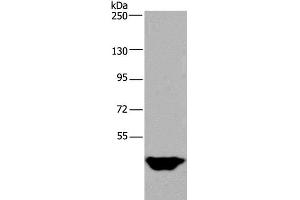 Western Blot analysis of Human testis tissue using MTF2 Polyclonal Antibody at dilution of 1:400 (MTF2 抗体)