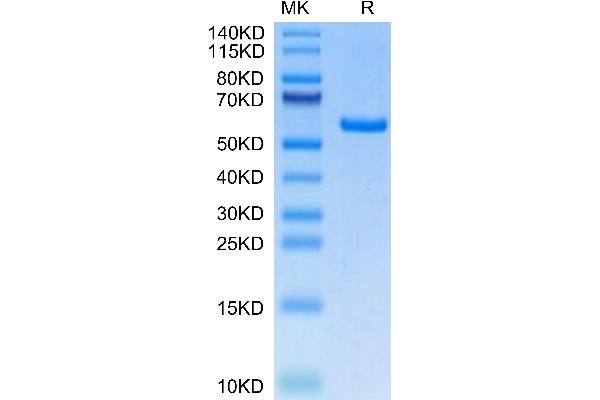 Ectodysplasin A2 Receptor Protein (EDA2R) (AA 1-138) (Fc Tag)