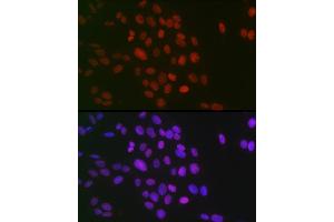 Immunofluorescence analysis of U-2 OS cells using Symmetric DiMethyl-Histone H3-R26 Rabbit pAb (ABIN3017473, ABIN3017474, ABIN3017475 and ABIN6220103) at dilution of 1:100 (40x lens). (Histone 3 抗体  (H3R26me2))