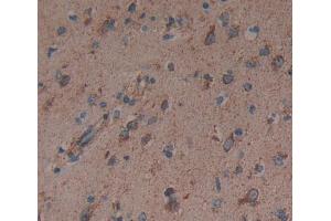 Used in DAB staining on fromalin fixed paraffin- embedded brain tissue (Dynamin 3 抗体  (AA 1-323))