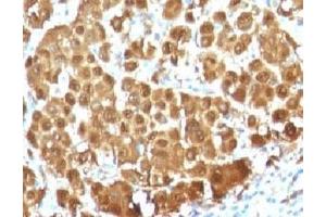 Immunohistochemistry (IHC) image for anti-S100 Calcium Binding Protein B (S100B) antibody (ABIN5646938)