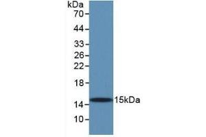 Detection of Recombinant TGFb1, Human using Monoclonal Antibody to Transforming Growth Factor Beta 1 (TGFb1) (TGFB1 抗体  (AA 279-390))