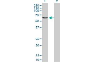 Western Blot analysis of OMD expression in transfected 293T cell line by OMD MaxPab polyclonal antibody. (Osteomodulin 抗体  (AA 1-421))