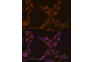 Immunofluorescence analysis of NIH-3T3 cells using KIFC1 Rabbit mAb (ABIN1680485, ABIN3015039, ABIN3015040 and ABIN7101305) at dilution of 1:100 (40x lens). (KIFC1 抗体)