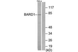 Western Blotting (WB) image for anti-BRCA1 Associated RING Domain 1 (BARD1) (AA 1-50) antibody (ABIN2889977) (BARD1 抗体  (AA 1-50))