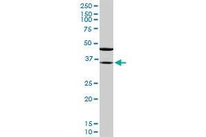 Western Blotting (WB) image for anti-Sorbitol Dehydrogenase (SORD) (AA 1-110) antibody (ABIN562952)