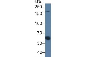 alpha 2 Macroglobulin 抗体  (AA 616-856)